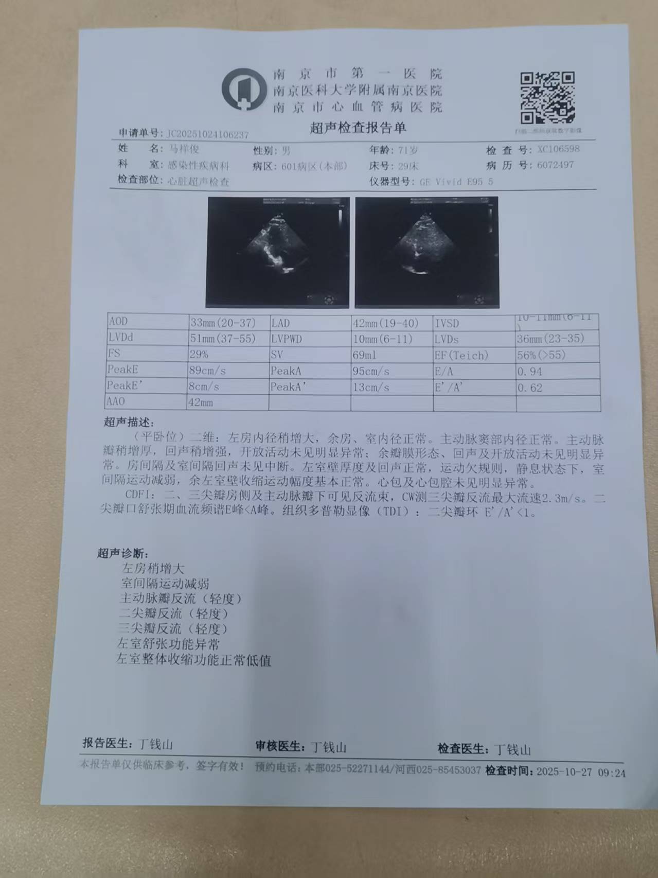 超声检查报告单